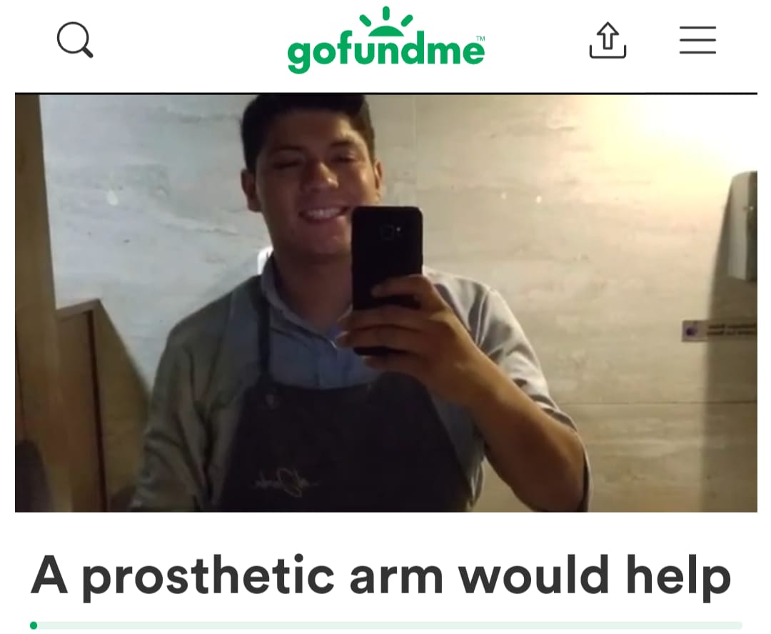 Padre de familia solicita ayuda para conseguir prótesis de brazo
